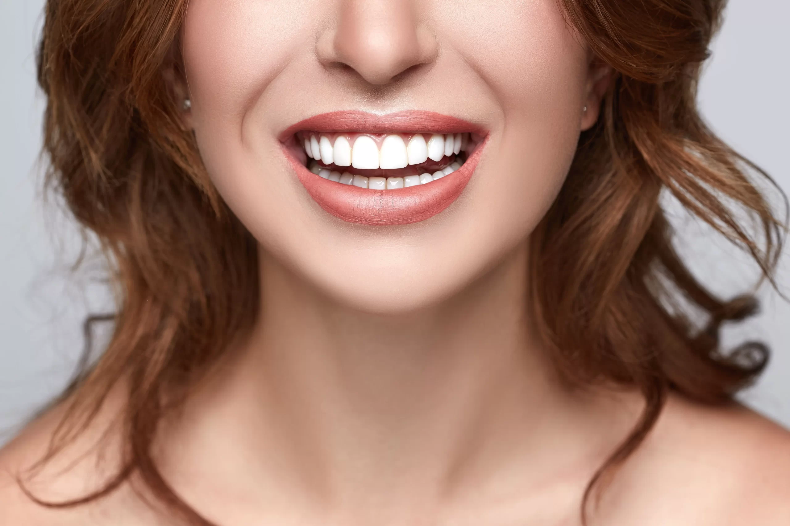 Hollywood Smile