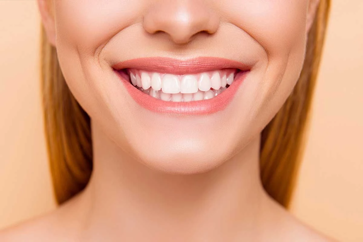Design del sorriso: migliora la tua sicurezza con soluzioni dentistiche esperte