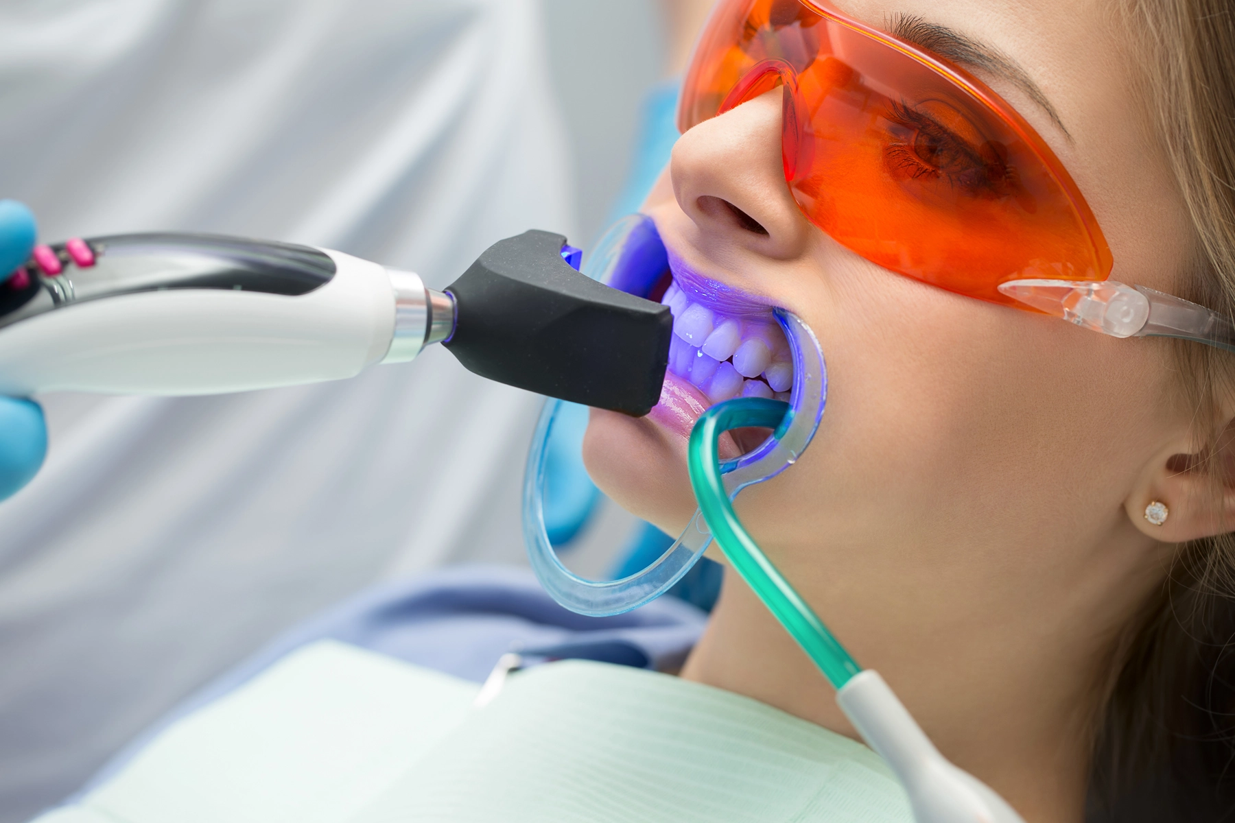 Best Treatment for Teeth Whitening