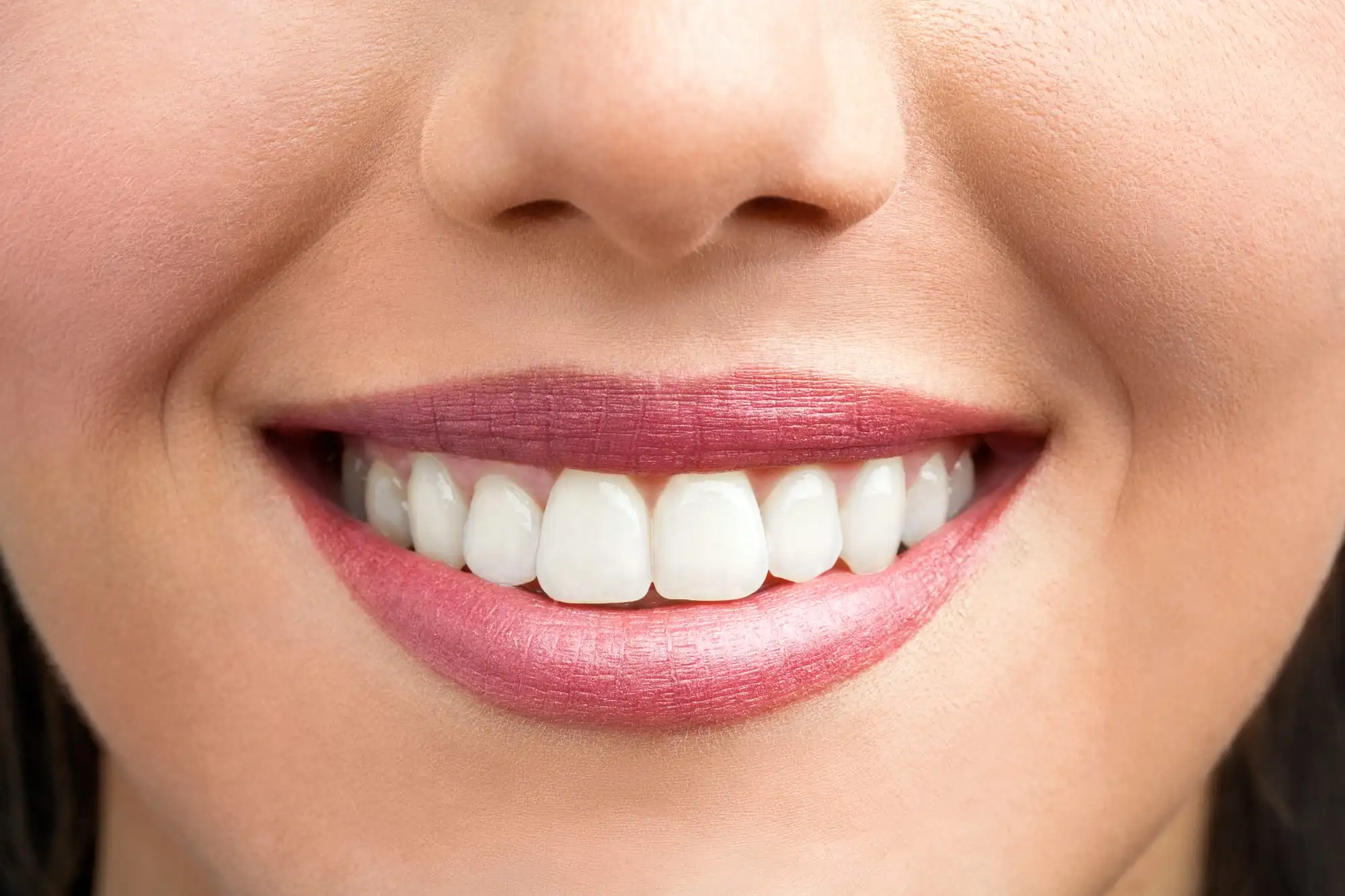 Smile Design : améliorez votre confiance avec des solutions dentaires expertes