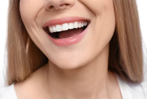 Hollywood Smile